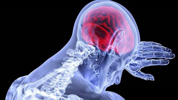 Are brain diseases surging post Covid?
