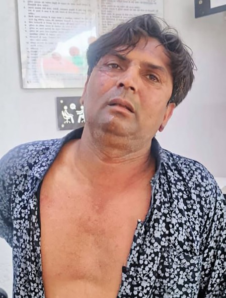 Delhi CM Attack Case Deepens; Police Arrest Rajesh's Associate Tahseen in Alleged Murder Plot